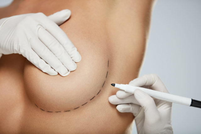 Tips til bröstoperationer